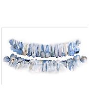 Dentist Pan X Ray Teeth Watercolor Art 17x11 Poster front