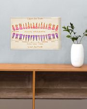 Dentist Upper And Low Teeth 17x11 Poster poster-landscape-17x11-lifestyle-24
