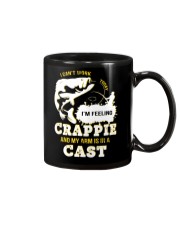 I Can't Work Today My Arm Is In A Cast AY81 Mug thumbnail