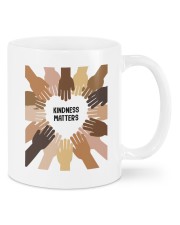 Kindness Matters Mugs tile