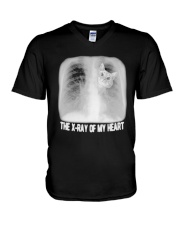 Cat The X Ray Of My Heart Shirt V-Neck T-Shirt thumbnail