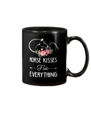 Kisses Fix Everything Mug tile
