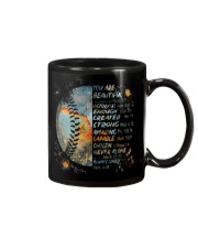 Softball You Are Beautiful Mug tile