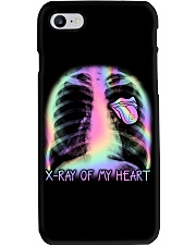 XRay Of My Heart Phone Case tile