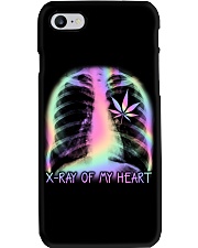 XRay Of My Heart Phone Case tile