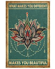 What Makes You Different Makes You Beautiful 24x36 Poster front