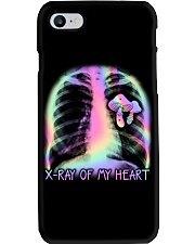 XRay Of My Heart Phone Case tile