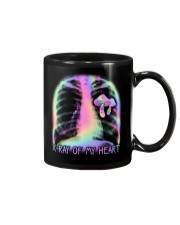 XRay Of My Heart Mug tile