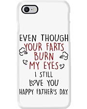 YOUR FARTS BURN MY EYES - MB130 Phone Case thumbnail
