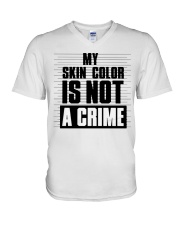 ONLY 17 TODAY V-Neck T-Shirt thumbnail