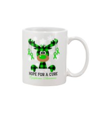 Hope For A Cure Lymphoma Awareness Mug tile