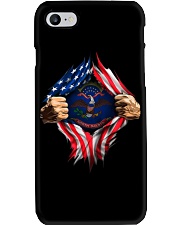 North Dakota Phone Case thumbnail