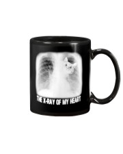 The X-Ray Of My Heart Mug tile