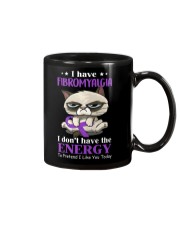 Limited Edition Mug tile