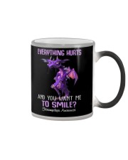 Everything hurts and you want me to smile Color Changing Mug tile