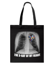 The X-ray of my heart Tote Bag tile