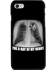 The X-ray of my heart Phone Case tile