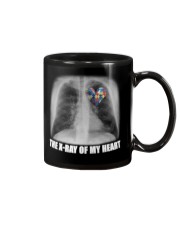 The X-ray of my heart Mug tile