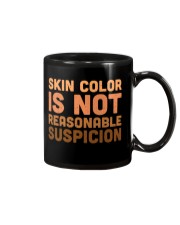 Skin color is not reasonable suspicion Mug tile