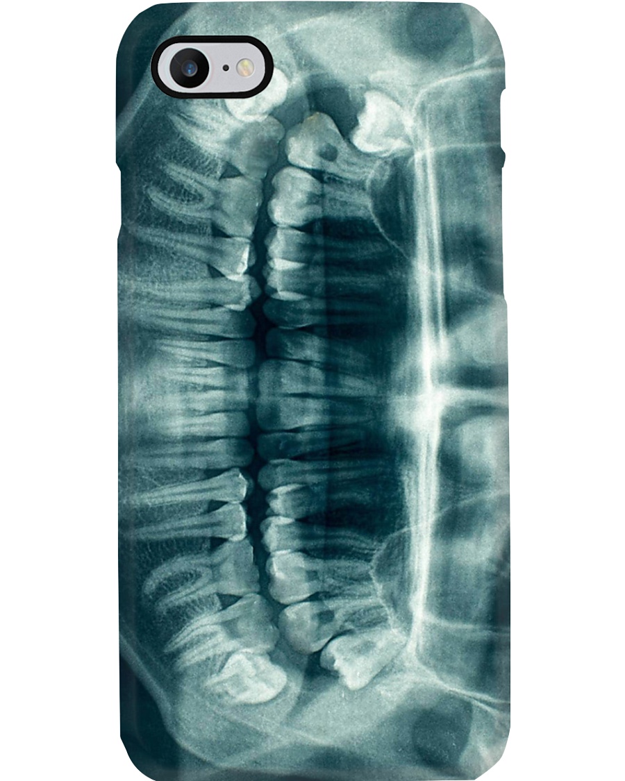 xray teeth Phone Case