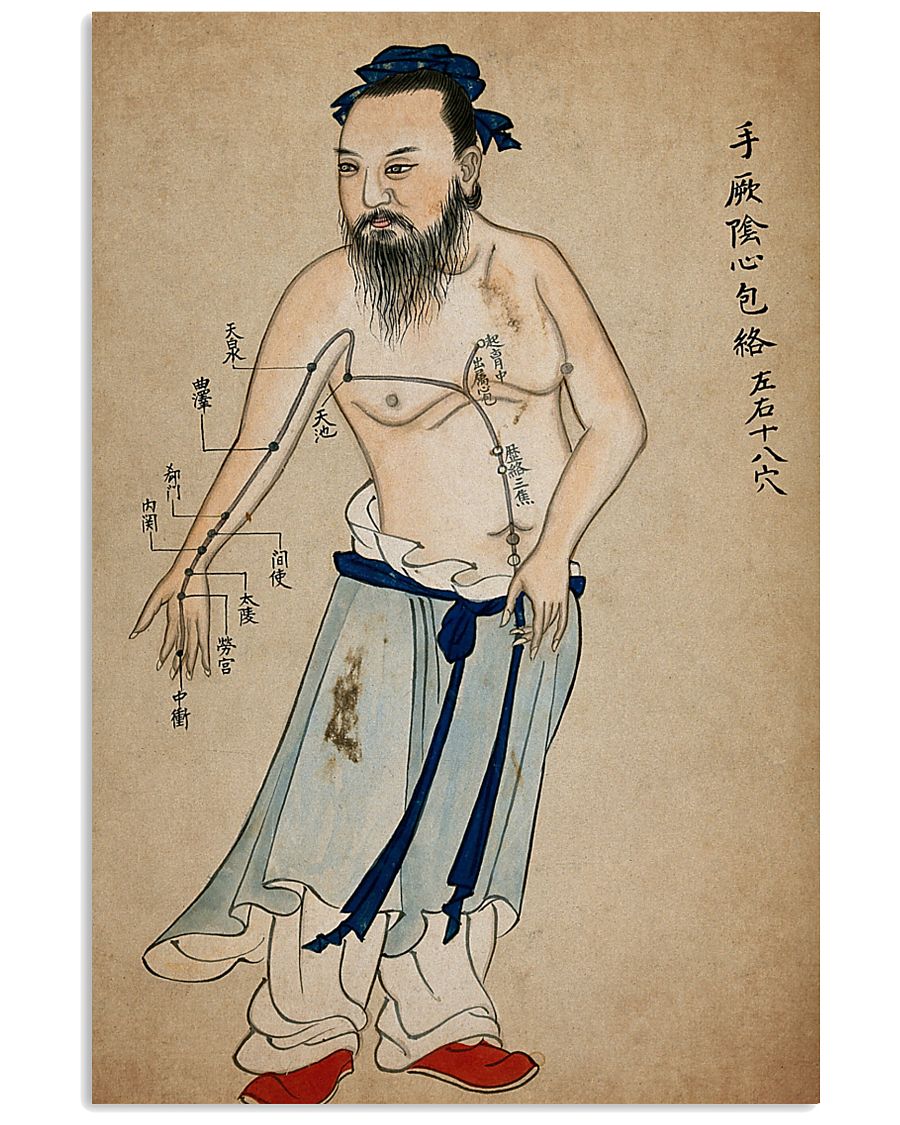 acupuncture print antique 4 24x36 Poster