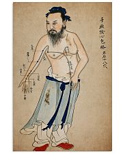 acupuncture print antique 4 24x36 Poster front