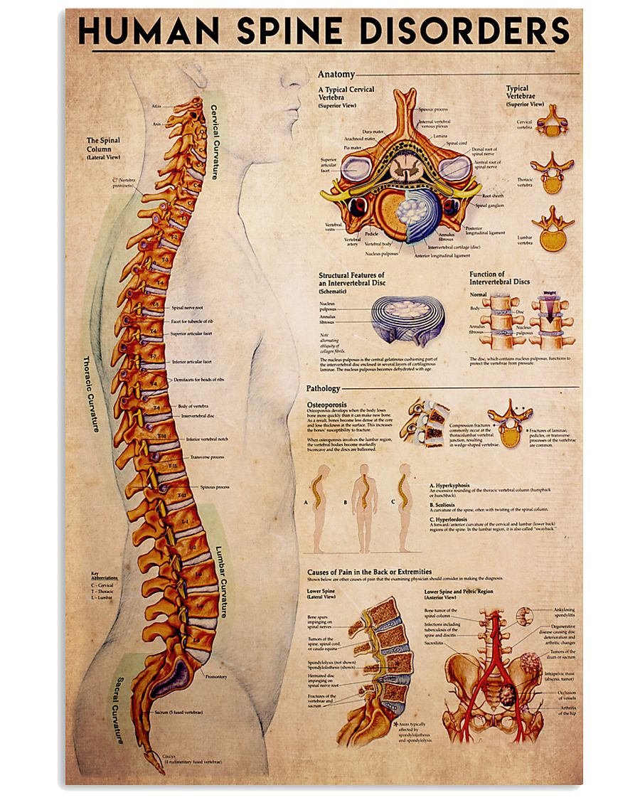 spine-disorder 24x36 Poster