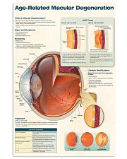age relate macular 24x36 Poster front