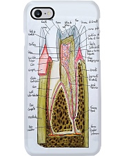 tooth anatomy case Phone Case i-phone-7-case