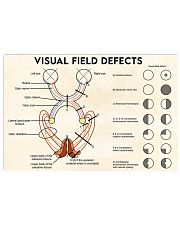 visual field defects 17x11 Poster front
