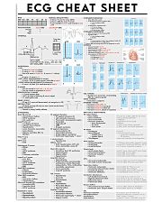 ecg cheatsheet 11x17 Poster front