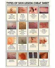 skin lesion 24x36 Poster front