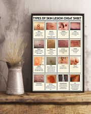 skin lesion 24x36 Poster lifestyle-poster-3