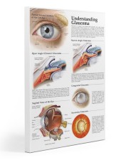 understand glaucoma 20x30 Gallery Wrapped Canvas Prints thumbnail