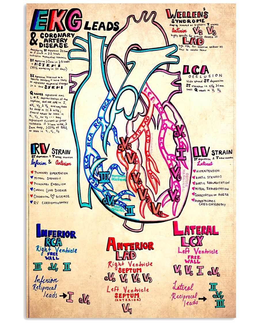 EKG lead doodle 11x17 Poster