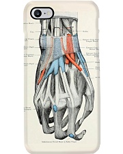 hand anatomy case Phone Case i-phone-8-case
