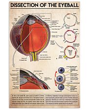 dissection-eyeball 11x17 Poster front