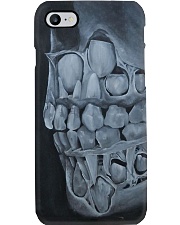 milk teeth Phone Case i-phone-8-case