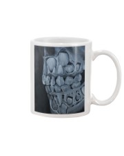 milk teeth Mug tile
