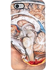 neuro side brain dvhd ntv Phone Case i-phone-8-case