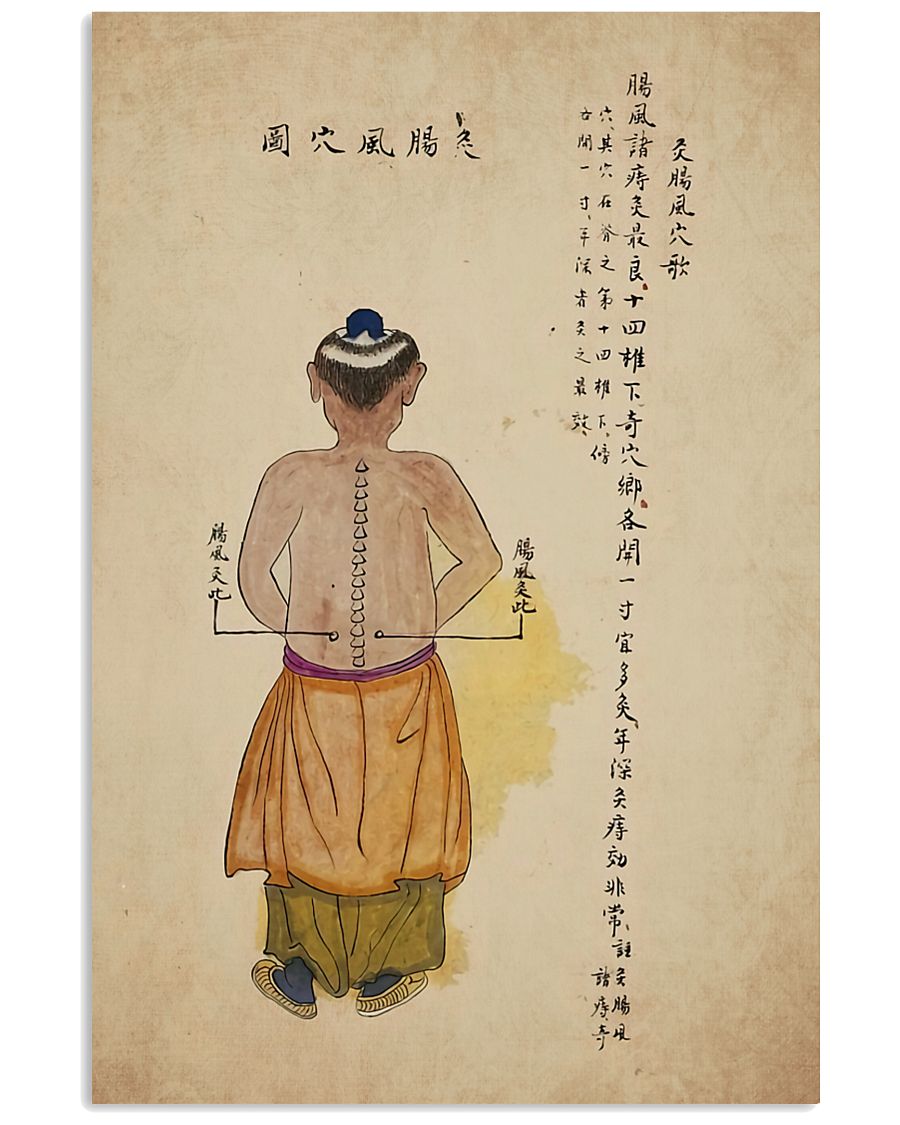acupuncture print antique 3 24x36 Poster