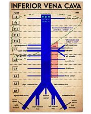 inferior vena cava 11x17 Poster front
