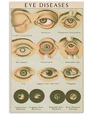 eye diseases 24x36 Poster front