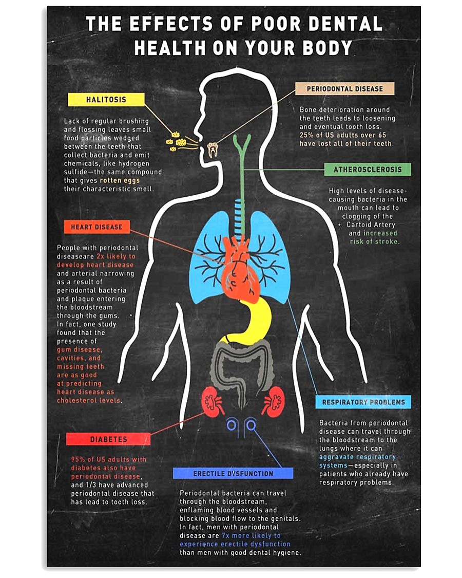 dental body 11x17 Poster