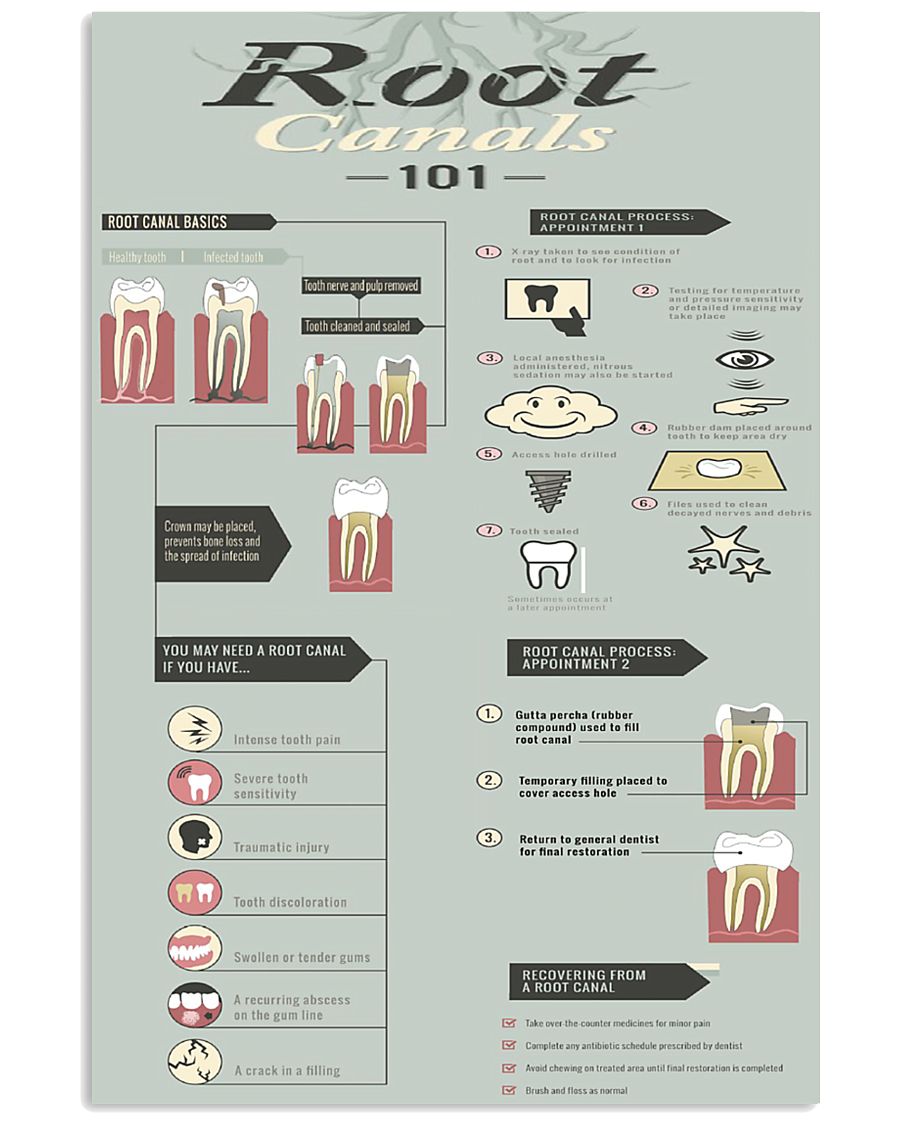 root canal 101 11x17 Poster