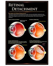 retinal detach 24x36 Poster front