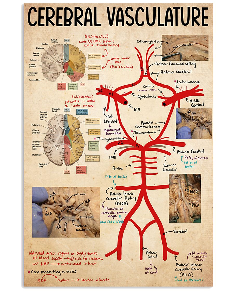 cerebral vasculature 11x17 Poster