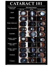 cataract type 1506 24x36 Poster front