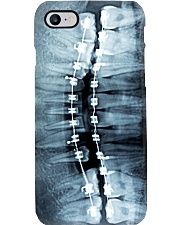 Xray Teeth Bracer phonecase Phone Case i-phone-8-case