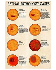 Retinal pathology cases 24x36 Poster front